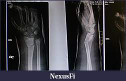 Click image for larger version

Name:	IMAG0873.jpg
Views:	231
Size:	722.5 KB
ID:	112780
