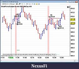 Click image for larger version

Name:	EMD10R_scalp.jpg
Views:	315
Size:	138.8 KB
ID:	12765