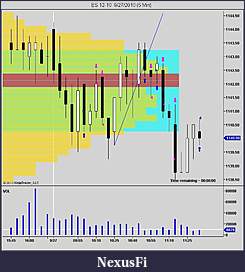 Click image for larger version

Name:	NinjaTrader Chart(4).JPG
Views:	288
Size:	183.0 KB
ID:	20927