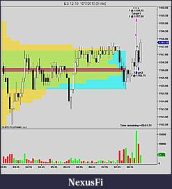 Click image for larger version

Name:	NinjaTrader Chart.jpg
Views:	258
Size:	71.4 KB
ID:	21976