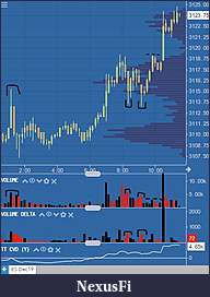 Click image for larger version

Name:	5-12 chart 2 10 mins.JPG
Views:	463
Size:	42.0 KB
ID:	281130