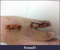 Click image for larger version

Name:	C360_2011-04-06 14-12-34.jpg
Views:	280
Size:	166.7 KB
ID:	36044