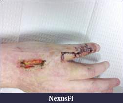 Click image for larger version

Name:	C360_2011-04-06 14-12-26.jpg
Views:	283
Size:	156.4 KB
ID:	36045