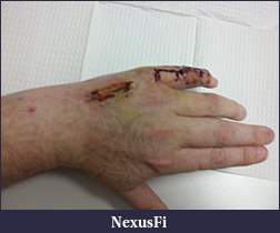 Click image for larger version

Name:	C360_2011-04-06 14-12-21.jpg
Views:	307
Size:	213.3 KB
ID:	36046